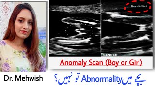 pregnancy ki ultrasound report kaise pade  placenta se jane ladka ya ladki  mommy expertise [upl. by Uv]