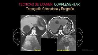 Diagnóstico por Imágenes en Hepatobiliopancreas [upl. by Opalina]