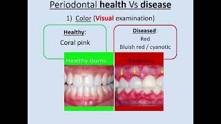 Periodontal chart page 1 [upl. by Bodkin]