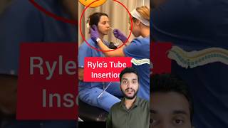 Ryles tube insertion shorts [upl. by Arutek633]