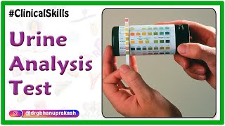 Urine analysis test procedure  Biochemistry Practicals [upl. by Ettevey]