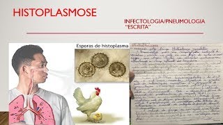 Tudo sobre HISTOPLASMOSE  InfectologiaPneumologia escrita AULA 27 [upl. by Tibbetts]