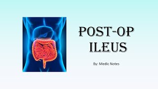 Postoperative ileus  patient and surgical factors clinical features investigation management [upl. by Macintyre]