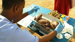 Malnutrition at record high in droughthit Somalia ICRC [upl. by Nerahs]