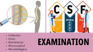 CSF Examination  Cerebrospinal Fluid  Collection  Gross  Biochemistry  Microscopy [upl. by Yhtomit]