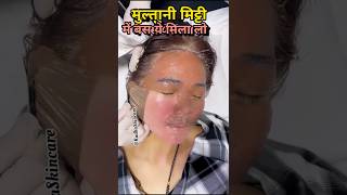 😱Multani Mitti Face Pack Get Fair Glowing Skin In Just 15 Minutes✅ shorts skincare RadhaSkincare [upl. by Lliw]