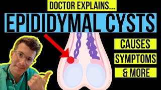 Doctor explains TESTICULAR LUMPS PART 1  EPIDIDYMAL CYSTS causes symptoms and treatments [upl. by Assenav]