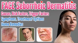 Seborrheic Dermatitis Face Causes Risk amp Trigger Factors Symptoms Treatment Options Home Remedies [upl. by Nettle]