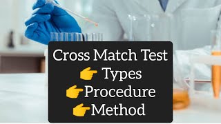 Cross Match Test  Procedure  Types  Method [upl. by Ahmad]