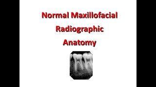 Normal Maxillofacial Radiography Anatomy Maxilla [upl. by Kcirrag305]