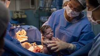 Caesarean section for pregnant give birth to 4 children [upl. by Adaline]