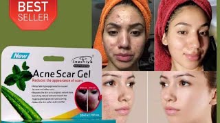 Acne Scar GelAcne and acne scar removal creamRemoves small black spots and smooths the face cream [upl. by Fanchet]