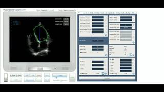 wwwmyechocardiographycom [upl. by Kayne]