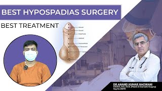 Best Hypospadias Surgeon in Kolkata  मूत्र का छिद्र सही जगह पर न खुलने की समस्या  Dr Nagwani [upl. by Duer]