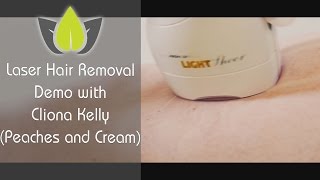 Laser hair removal treatment with Peaches amp Cream [upl. by Vasilis]