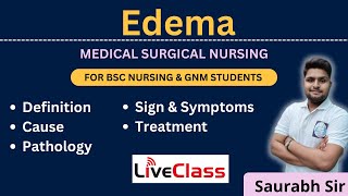 Edema  medical surgical nursing  For Bsc Nursing and GNM students [upl. by Sibyls]