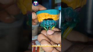 How to Make  Wax Pattern Design Ceramic Bridge  PFM  6 Units  Tamil Dental Lab  dentalceramic [upl. by Drape891]