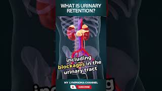 What is urinary retention shorts [upl. by Comstock]