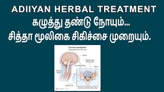 Cervical Spondylitis  கழுத்து சப்ளிடிஸ்  Adiiyan Herbal Treatment Ep 45 [upl. by Ayanej564]