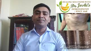 Lipoma Homeopathic Medicine For lipoma [upl. by Intyrb786]