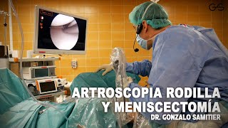 ARTROSCOPIA RODILLA Y MENISCECTOMÍA [upl. by Rehpotsihc422]