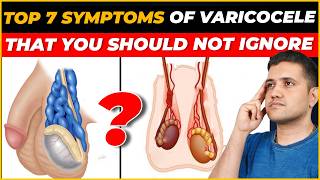 Top 7 Symptoms of Varicocele You Shouldn’t Ignore  Best Treatment Explained by Dr Gaurav Gangwani [upl. by Enyak654]