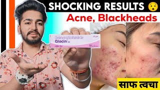 METROGYL P 2  cream Vs BETADINE  How to use in Hindi  FISTULA ABSCESS Infection  Wound Dressing [upl. by Fanchette611]