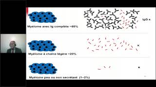 GAMMAPATHIE MONOCLONALE ROLE DU LABORATOIRE [upl. by Lash263]