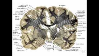 Neuropathology101Basic Neurohistology and NonNeoplastic lesionsmov [upl. by Kcirdneked932]