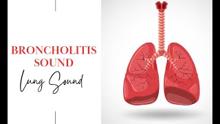 Bronchiolitis sound  Bronchiolitis Breathing Sound Bronchiolitis pediatrics [upl. by Frick]