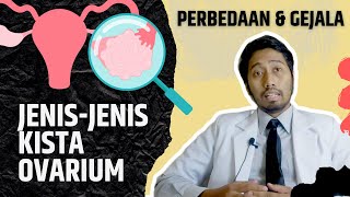 Jenis jenis kista ovarium beserta perbedaan dan gejalanya [upl. by Lukas]