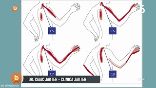 Dolor en brazos cuello o cabeza  Dr Isaac Jakter [upl. by Tatiana]