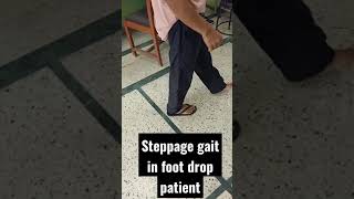 What is Steppage gait in foot drop patient  What is foot drop gait  high steppage gait [upl. by Euginom]