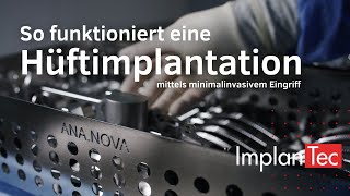 So funktioniert eine Hüftimplantation HüftOP mittels minimalinvasivem Eingriff [upl. by Sezen]