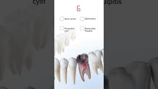 Anatomy quiz  oral pathology in 3D  Have you guessed it right anatomy 3danatomy [upl. by Brocky]