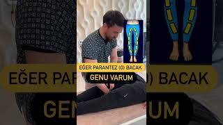 Eğer Parantez Bacaksanız  O Bacak  Dikkat [upl. by Slorac]