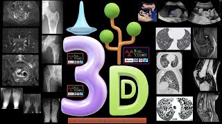 TOP THREE DIFFERENTIAL DIAGNOSIS SET II [upl. by Tevis942]