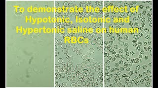 RBCs in Hypotonic Isotonic and Hypertonic solution Practical Lab [upl. by Wollis]