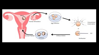 Fr Stephen Imbarrato explains quotHow can in vitro fertilization IVF be wrong if it creates livesquot [upl. by Yragerg793]