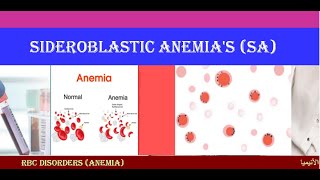 Lecture 17 Sideroblastic Anemia  SA [upl. by Tereb]