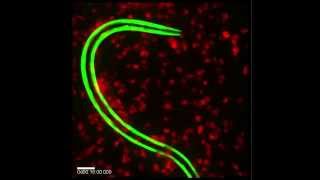 Eosinophils Sticking to a Worm [upl. by Verge]