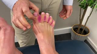 Bunion Causes and Treatment Options [upl. by Evad]