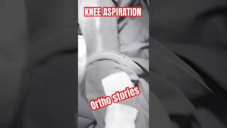 Knee swelling orthopedics bestorthodoctor doctorabin orthopedicsurgeon holisticmedicine [upl. by Gena]