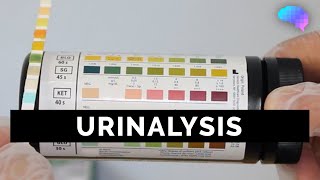 Urinalysis  OSCE Guide old version  UKMLA  CPSA [upl. by Berry]