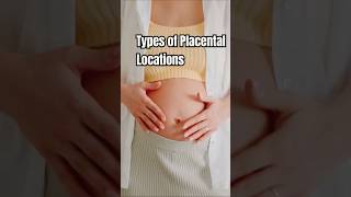 Placental Locations pregnancy placentapositionduringpregnancy [upl. by Wanonah]