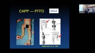 Biomechanics of Human Performance Musculoskeletal Adaption and Injury By Dr Ron Zernicke [upl. by Seys]