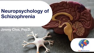 Neuropsychology of Schizophrenia [upl. by Ennyroc]