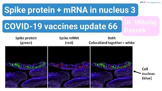 Spike protein and mRNA in nucleus 3  NEW EVIDENCE  COVID19 vaccines update 66 [upl. by Maurene]