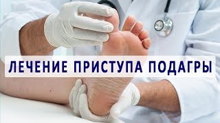 Лечение подагры при обострении [upl. by Ecidnac]