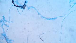 Fusarium solani in LPCB mount Showing Micronidia on long PhialidesMacronidia and Chlamydospores [upl. by Eilesor]